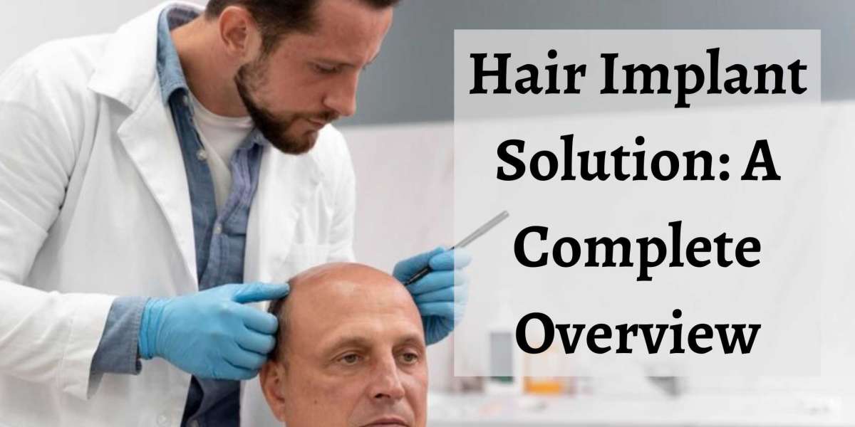 Hair Implant Solution: A Complete Overview